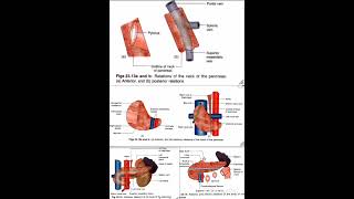 Pancreas Relations Anatomy Quick Revision University Exam [upl. by Onimixam420]