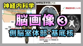 【脳画像③】側脳室体部・基底核レベル【理学療法士・作業療法士】 [upl. by Aligna]