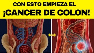 Las 10 PRIMERAS SEÑALES de CÁNCER DE COLON que nunca debes ignorar [upl. by Schreibe247]