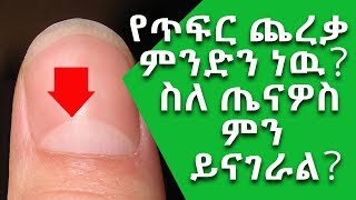 Ethiopia የጥፍር ጨረቃ ምንድን ነው ስለ ጤናዎስ ምን ይናገራል  Nuro Bezede [upl. by Kcoj]