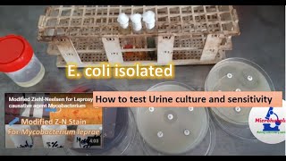 How to test urine culture and sensitivity [upl. by Anoli]