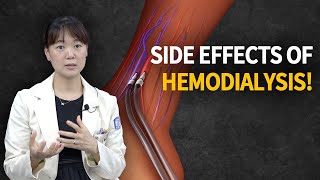 Hemodialysis Side Effects How It Works amp What You Need to Know [upl. by Mallissa]