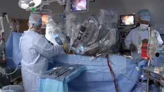 Laparoscopic vs Robotic [upl. by Girardo611]