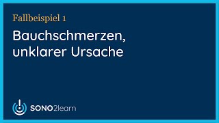 Bauchschmerzen unklarer Ursache  Ultraschall  Fallbeispiel 1 [upl. by Crescen]