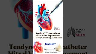 Tendyne™ Transcatheter Mitral Valve Replacement TMVR  Cardiology Animation 3d short [upl. by Jermayne]