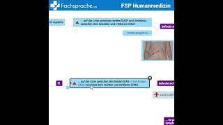 So beschreiben Sie die Lokalisation von McBurney und LanzPunkt [upl. by Norda]