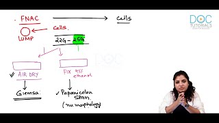 Neoplasia Diagnosis part 2  FNAC  General Pathology  DocTutorials [upl. by Llenrahs]