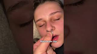 Instantly stops snoring🤯🤯 mouthbreathing snoringhusband snoring snoreclips sleepapnea [upl. by Tloc]