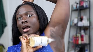 I tried Glycolic Acid On My Armpits and It Did This Instead😱 Im SHOOK😱  Ohemaa [upl. by Orola]