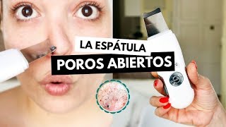 Pruebo la ESPÁTULA ULTRASÓNICA contra POROS ABIERTOS y sebo facial  Pretty and Olé [upl. by Chlores639]