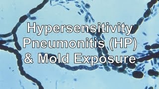 Hypersensitivity Pneumonitis amp Mold Exposure [upl. by Allerim191]