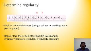 12 lead ECG interpretation Dr S Prakash Babu [upl. by Attelrac]