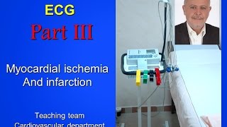 ECG part III [upl. by Mathi]