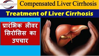 Treatment of liver cirrhosis  chronic liver disease  compensated cirrhosis [upl. by Waine]