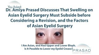 How Swelling after Can Cause a Temporary Increase in Eyelid Height after Asian Eyelid Surgery [upl. by Anirehc]