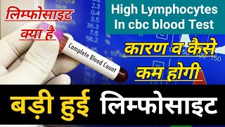 High Lymphocytes In Blood Test Causes Treatment  high lymphocytes in hindi लिम्फोसाइट्स क्या है [upl. by Flavian114]