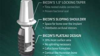 Introduction to Bicon SHORT® Implants [upl. by Milla936]