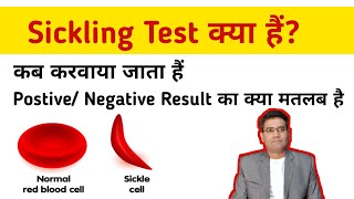 Sickling Test in Hindi  Use Postive and Negative Result Means  Price  Sickle Cell Anemia [upl. by Nayrda]