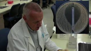 Etest for antibiotic susceptibility [upl. by Nilved467]