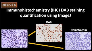 Immunohistochemistry IHC DAB staining quantification using ImageJ [upl. by Yorle]