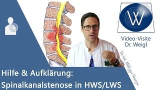 Spinalkanalstenose Rückenschmerzen durch Spinalstenose in HWS LWS ⚡ Symptome Gefahren amp Therapie [upl. by Walcott]