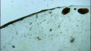 Zooplankton Seed Shrimp Under the Microscope Microorganisms Ep 3 [upl. by Daren666]