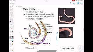 Ascaris Lumbricoides  Panikers  Apurba S Sastry [upl. by Aenil]