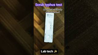 Scrub typhus test lab labtechnician [upl. by Brathwaite]