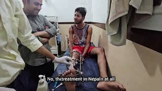 nepal ke patient ka ILIZAROV FRAME REMOVE HO GYA [upl. by Nicol]