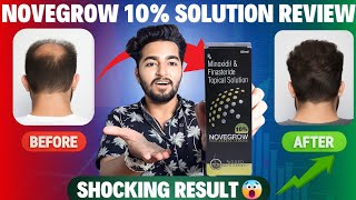 Novegrow 10 Minoxidil Solution Review  Minoxidil Finasteride Solution Added With Capixyl [upl. by Lurlene88]