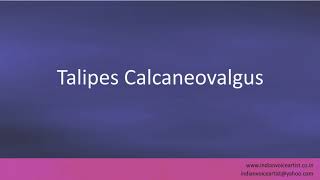 Pronunciation of the words quotTalipes Calcaneovalgusquot [upl. by Yemarej]