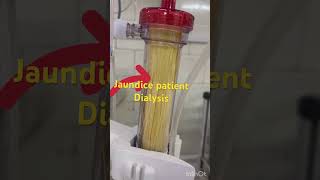 Jondice patient का डायलिसिस होने के बाद कैसे हो जाती है dialyzer dialysis kaise hota haidialysis [upl. by Wildon]