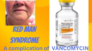 RED MAN SYNDROME A COMPLICATION OF VANCOMYCIN INFUSION [upl. by Anderea]