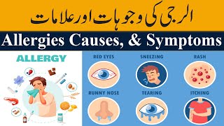 What is Allergy  Causes Signs and Symptoms Must Watch [upl. by Patsis]