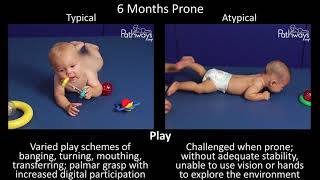 6 Month Old Baby Typical amp Atypical Development Side by Side [upl. by Nitsu]