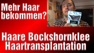 Bockshornklee Nach Haartransplantation Erfahrung Franky Haare Medical Exclusive Türkei [upl. by Zucker]