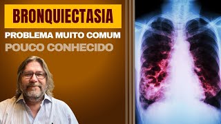 Bronquiectasias problema pulmonar desconhecido mas muito comum [upl. by Eyr85]