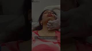 Double Chin Lipolysis Treatment [upl. by Alecia]