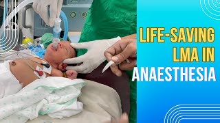 Lifesaving LMA in anaesthesia  LMA uses advantages and disadvantages are discussed [upl. by Aitel169]