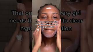 How to fade hyperpigmentation FAST [upl. by Nivahb]