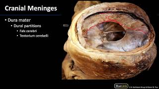 Cranial Cavity and Brain  Meninges and Dural Partitions [upl. by Emawk]