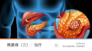 胰腺癌（三）：胰腺癌的治疗选择。最新的胰腺癌的治疗临床研究 [upl. by Merwin]