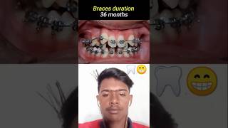 How to treat teeth viralreels viralytshorts viralshortsviralvideo trending dentist medical [upl. by Emelita]