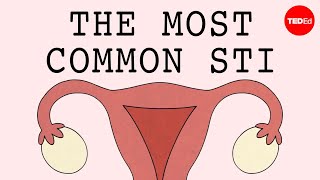 The most common STI in the world  Emma Bryce [upl. by Standish]