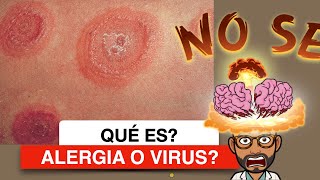 Alergia o virus que significa en los niños DrB te lo explica Dermatológico Pediatria [upl. by Munford525]