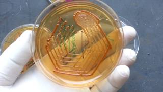 Cryptococcus neoformans growth on SDA  BSA urea hydrolization Positive [upl. by Annibo]