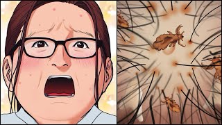 ASMR ANIMATION 😱  Head Lice Removal Animation [upl. by Reinar141]