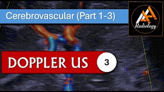 3  Cerebrovascular System Part 13 [upl. by Eldrid]