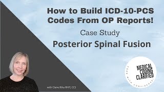 ICD 10 PCS Coding Posterior Spinal Fusion Case Study [upl. by Initirb445]