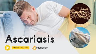 Ascariasis  Infectious Medicine Video  Medical Online Education  VLearning™ [upl. by Felicia970]